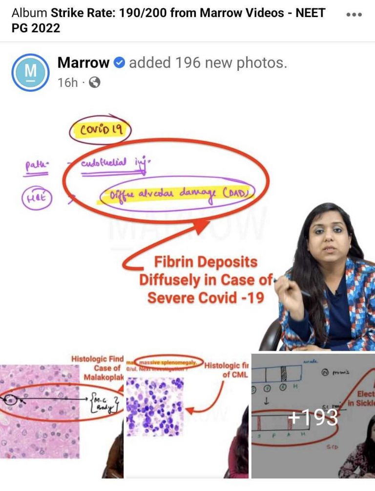 Marrow Strike Rate In NEET PG 2022 191 200 QBank Tests 190 200